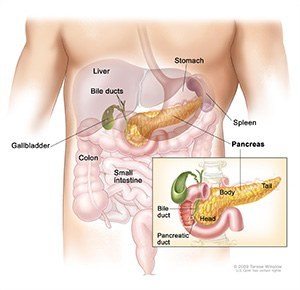 pancreatic cancer sydney